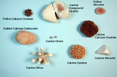 calcium oxalate stone